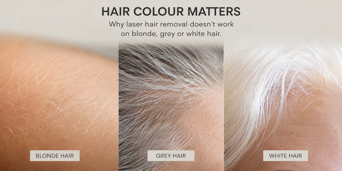an image of blonde, grey and white hair, and why laser hair removal doesn't work on these.