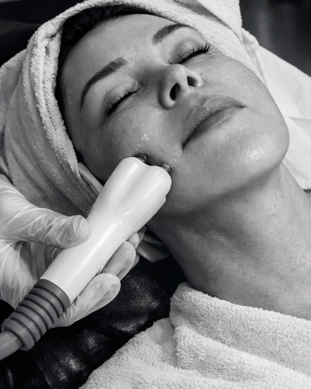 a woman is receiving a Radiofrequency treatment to tighten skin and firm her jawline.